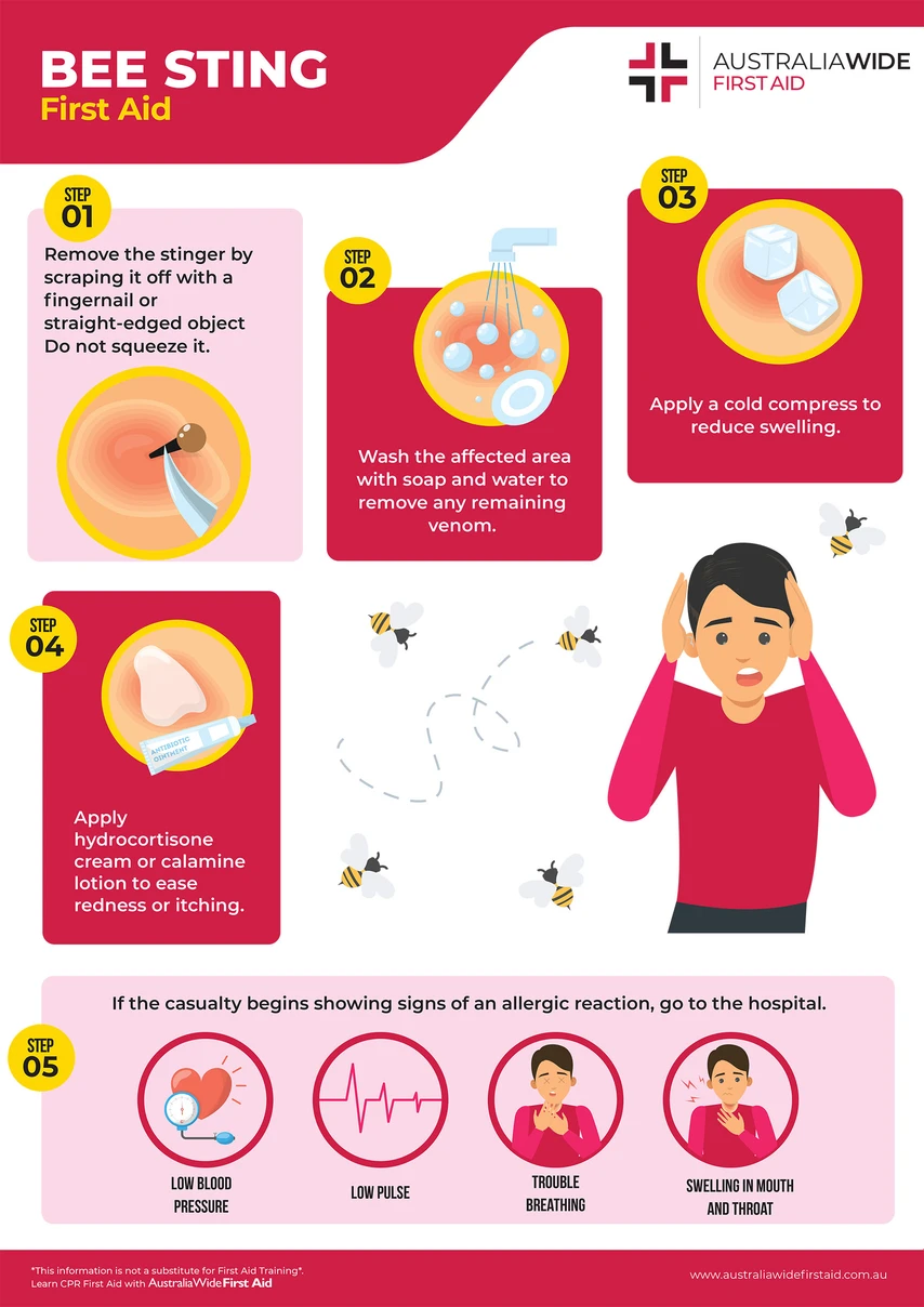 bee-sting-chart